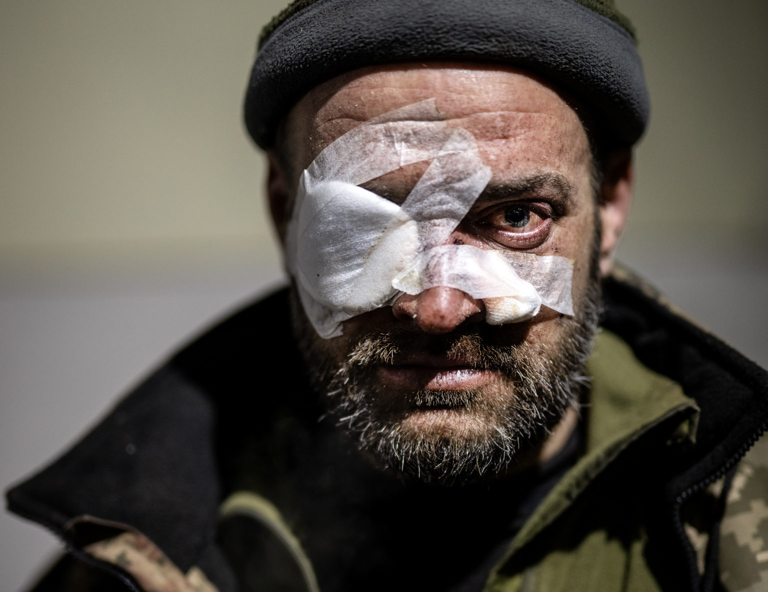 Zlikvidujete ich a oni stále prichádzajú a prichádzajú. Je ich veľmi veľa," povedal Pavlo, ukrajinský vojak, ktorému raketometný granát zranil oko. Foto: Lynsey Addario/New York Times