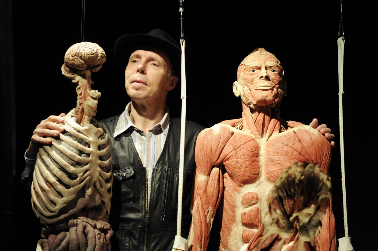 Gunther von Hagens, a jeho diela. Foto: profimedia.sk