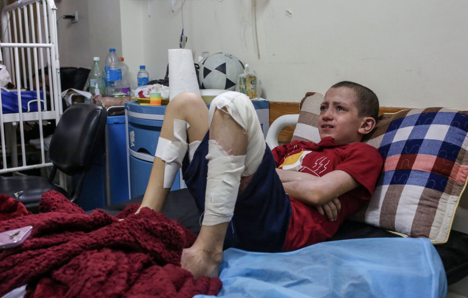 Mohamed Abu Rteinah popálený bombovým výbuchom. Foto: Samar Abu Eloufová pre New York Times
