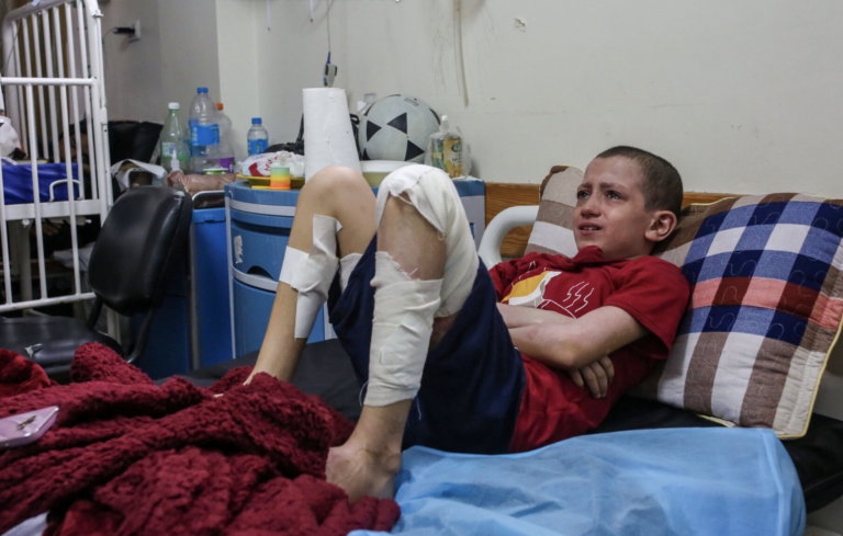 Mohamed Abu Rteinah popálený bombovým výbuchom. Foto: Samar Abu Eloufová pre New York Times