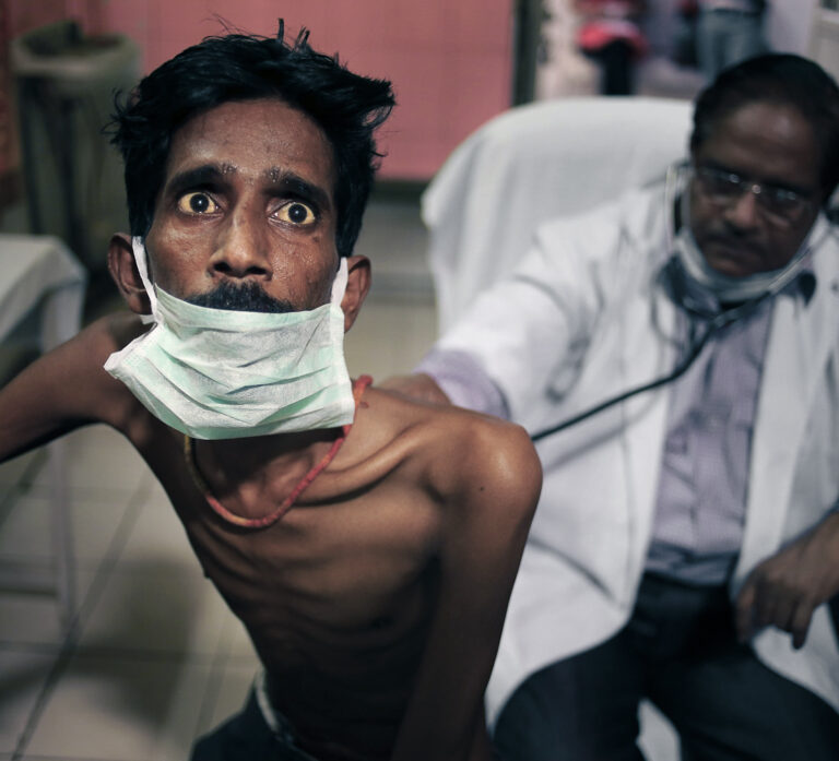 Indický lekár vyšetruje pacienta s tuberkulózou. Zdroj: ČTK / AP / Rajesh Kumar Singh