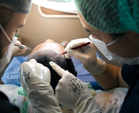 Turkish hair transplant clinics may get serious competition