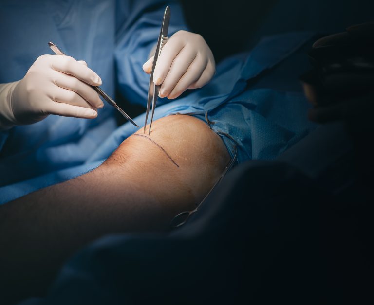 Ilustračná foto. Foto: Marcus Chung / Getty Images