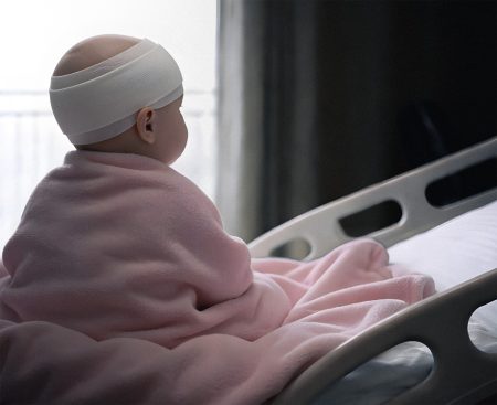 Unikátna operácia v Česku: lekári „odpojili“ časť mozgu a dieťa s epilepsiou je bez záchvatov
