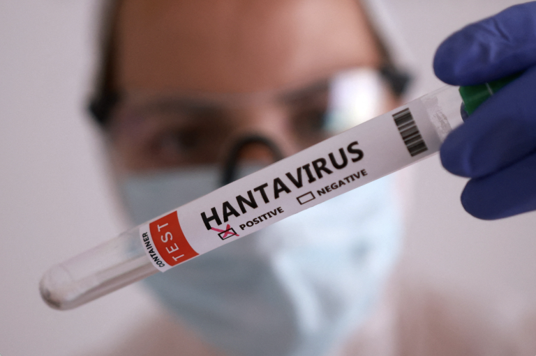 {"sk_alt_text":"Ilustratívna fotografia skúmaviek s nápisom "hantavirus."","en_alt_text":"Illustrative photo of test tubes labeled "hantavirus."","sk_source_text":"Ilustratívna fotografia skúmaviek s nápisom "hantavirus." Zdroj: Dado Ruvic/Reuters","en_source_text":"Illustrative photo of test tubes labeled "hantavirus." Source: Dado Ruvic/Reuters"}